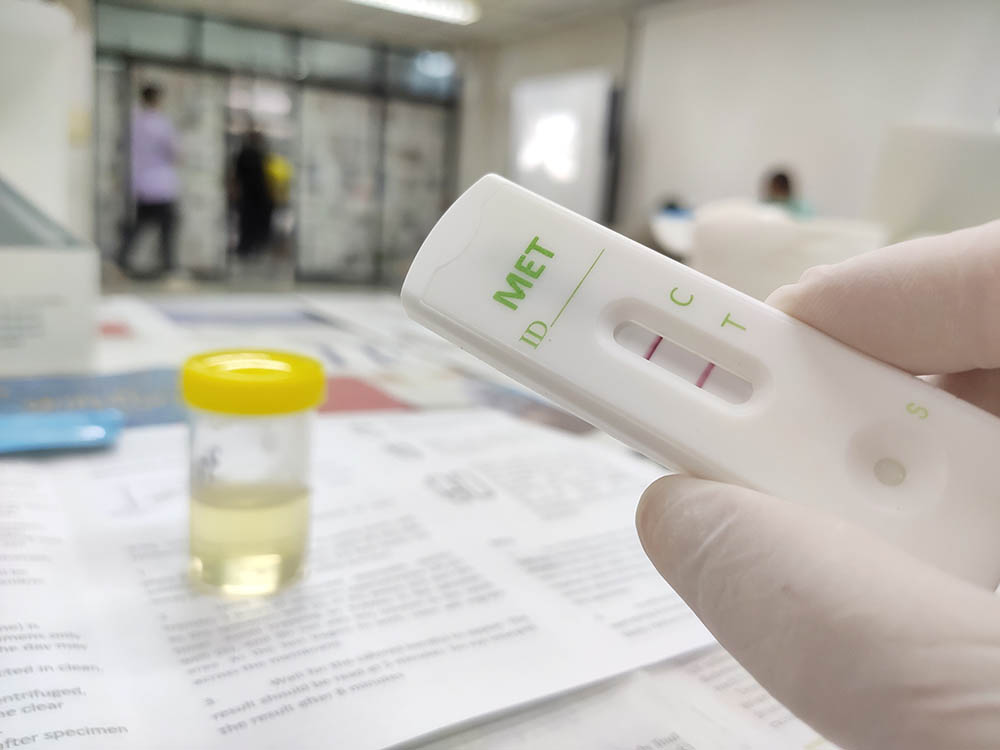Can Coffee Cause a False Positive Drug Test? What You Need to Know