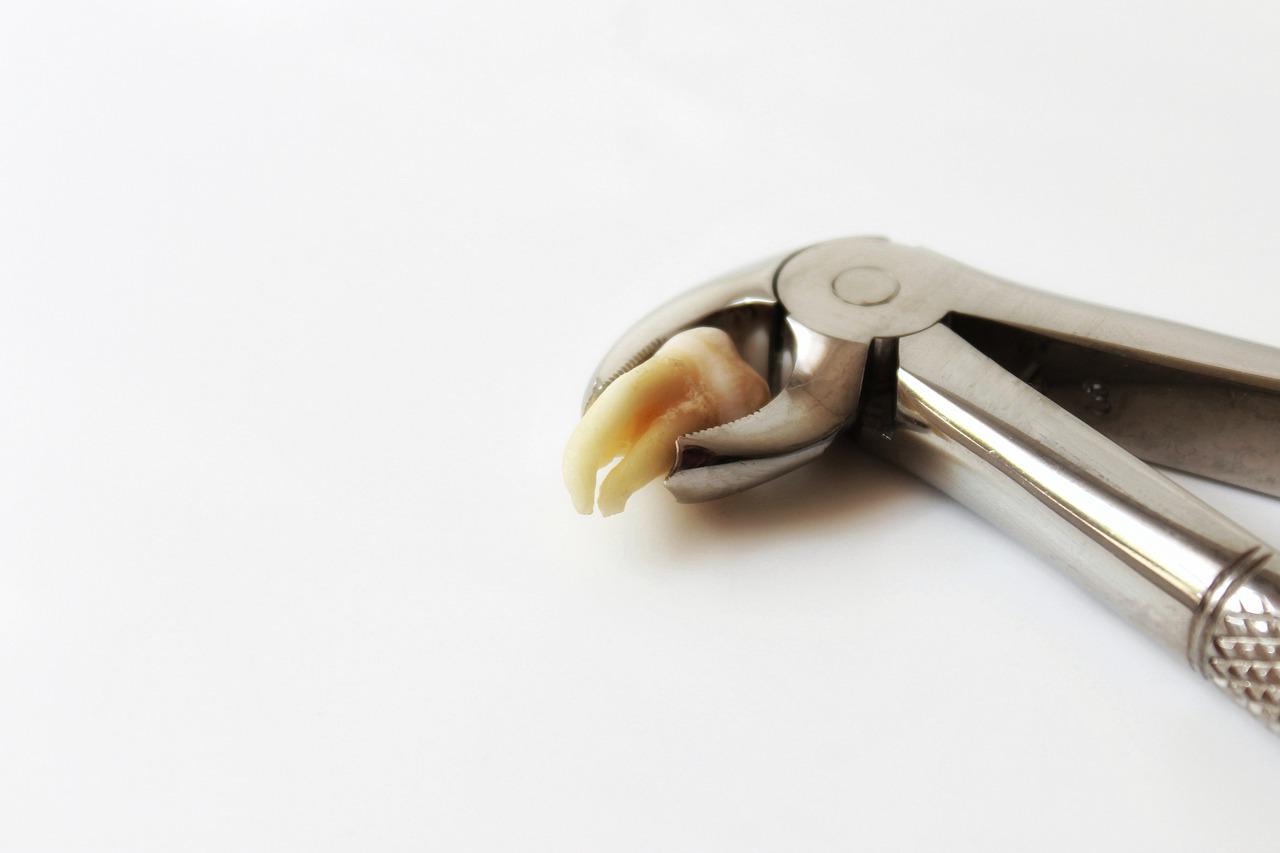 extracted tooth